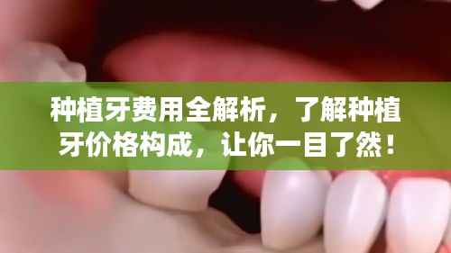 种植牙费用全解析,了解种植牙价格构成,让你一目了然!