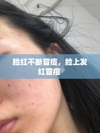 脸红不断冒痘,脸上发红冒痘